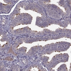Pierce-1 Antibody, Novus Biologicals 25 &mu;L; Unlabeled:Antibodies, Polyclonal